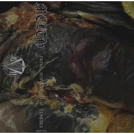 Melth - Fatal Suffusion of Tissues TAPE